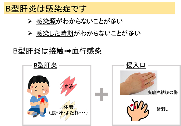 B型肝炎は感染所です。感染源が解らないことが多い。感染した時期が解らないことが多い。B型肝炎は接触→血行感染